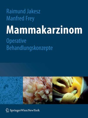 cover image of Mammakarzinom
